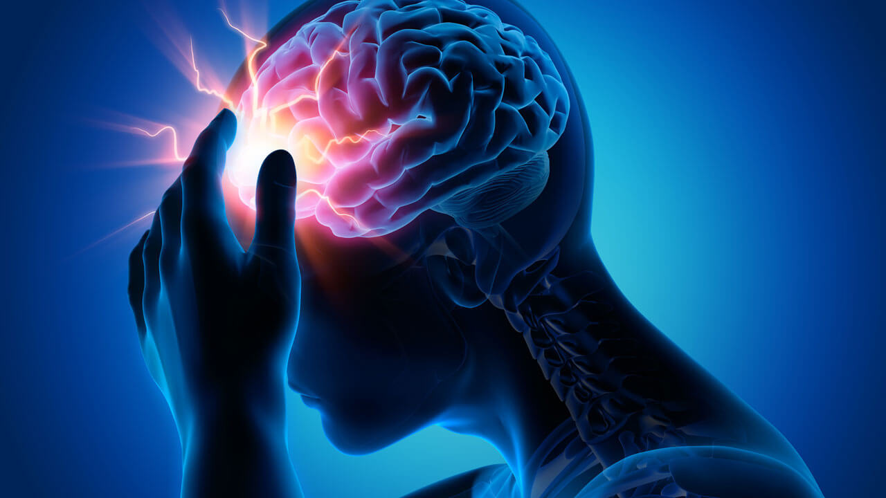 moždani udar, katastrofalna bolest | Zdravlje i prevencija, trendovi u medicini, magazin